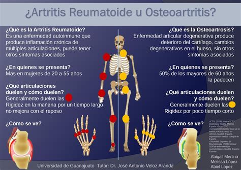 osteoartritis que es-4
